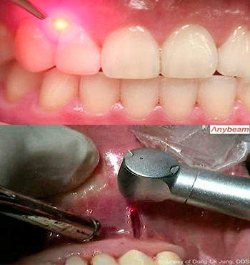 Best root canal & laser Specialist in Bhopal