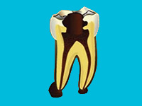 Best root canal & laser Specialist in Bhopal