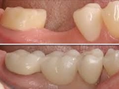 Best dentist in bhopal