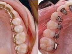 Best dentist in bhopal