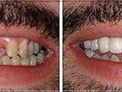 Best dentist in bhopal