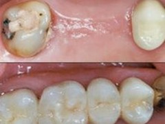 Best dentist in bhopal