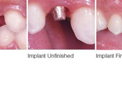 Best dentist in bhopal