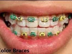 Best dental implant centre in bhopal