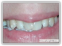 Best root canal & laser Specialist in Bhopal