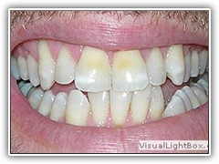 Best dentist in bhopal