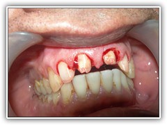 Best dentist in bhopal