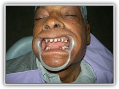 Best dentist in bhopal