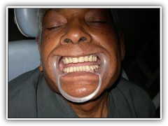 Best root canal & laser Specialist in Bhopal