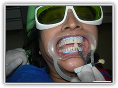 Best dental implant centre in bhopal