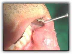 Best dentist in bhopal