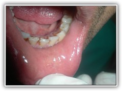 Best dentist in bhopal