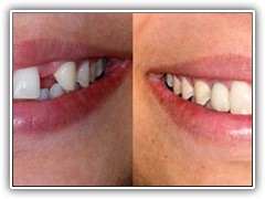 Best dentist in bhopal