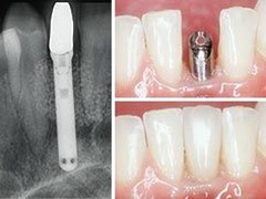 Best dentist in bhopal