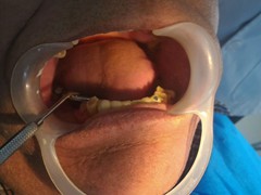 Best dentist in bhopal