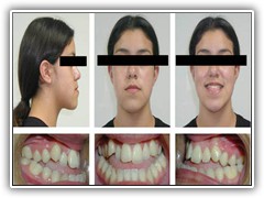 Best root canal & laser Specialist in Bhopal