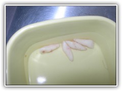 Best root canal & laser Specialist in Bhopal